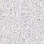 LMCD1 Antibody in Immunohistochemistry (Paraffin) (IHC (P))