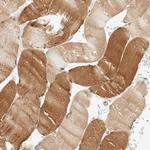 LMCD1 Antibody in Immunohistochemistry (Paraffin) (IHC (P))