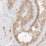 LMCD1 Antibody in Immunohistochemistry (Paraffin) (IHC (P))