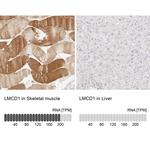 LMCD1 Antibody in Immunohistochemistry (IHC)