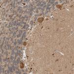 PXK Antibody in Immunohistochemistry (Paraffin) (IHC (P))