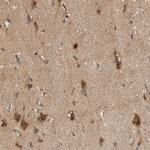 PXK Antibody in Immunohistochemistry (Paraffin) (IHC (P))