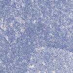 GDA Antibody in Immunohistochemistry (IHC)