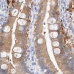 GDA Antibody in Immunohistochemistry (IHC)