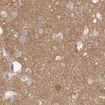 GDA Antibody in Immunohistochemistry (IHC)