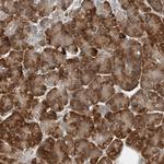 CLCN2 Antibody in Immunohistochemistry (Paraffin) (IHC (P))