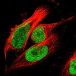 TOP2B Antibody in Immunocytochemistry (ICC/IF)