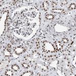 TOP2B Antibody in Immunohistochemistry (Paraffin) (IHC (P))