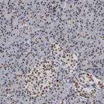 TOP2B Antibody in Immunohistochemistry (Paraffin) (IHC (P))