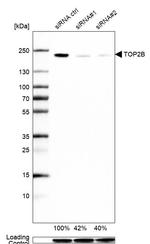 TOP2B Antibody in Western Blot (WB)