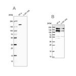 TOP2B Antibody in Western Blot (WB)