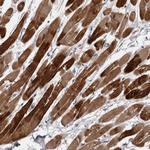 PPP1R12B Antibody in Immunohistochemistry (Paraffin) (IHC (P))