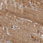 PPP1R12B Antibody in Immunohistochemistry (Paraffin) (IHC (P))