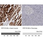 PPP1R12B Antibody in Immunohistochemistry (IHC)