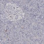 PPP1R12B Antibody in Immunohistochemistry (IHC)