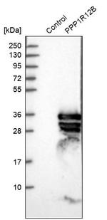 PPP1R12B Antibody in Western Blot (WB)