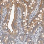 TRIT1 Antibody in Immunohistochemistry (Paraffin) (IHC (P))