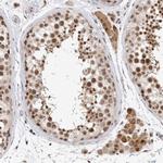 HESX1 Antibody in Immunohistochemistry (IHC)