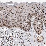 HESX1 Antibody in Immunohistochemistry (IHC)