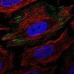 PGM1 Antibody in Immunocytochemistry (ICC/IF)