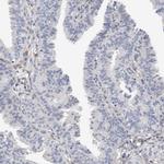 PGM1 Antibody in Immunohistochemistry (Paraffin) (IHC (P))