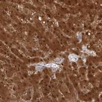 PGM1 Antibody in Immunohistochemistry (Paraffin) (IHC (P))