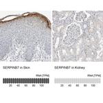 SERPINB7 Antibody in Immunohistochemistry (IHC)