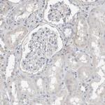 SERPINB7 Antibody in Immunohistochemistry (IHC)