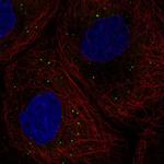 DDX6 Antibody in Immunocytochemistry (ICC/IF)