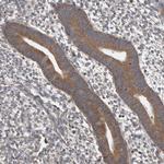 DDX6 Antibody in Immunohistochemistry (Paraffin) (IHC (P))