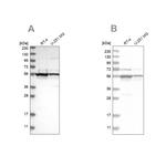 DDX6 Antibody in Western Blot (WB)