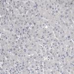 KIF18B Antibody in Immunohistochemistry (Paraffin) (IHC (P))