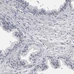 KIF18B Antibody in Immunohistochemistry (Paraffin) (IHC (P))