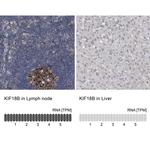 KIF18B Antibody in Immunohistochemistry (IHC)