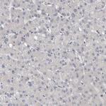 KIF18B Antibody in Immunohistochemistry (IHC)