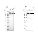 IARS2 Antibody in Western Blot (WB)