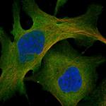 MYO10 Antibody in Immunocytochemistry (ICC/IF)