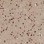 CPSF2 Antibody in Immunohistochemistry (Paraffin) (IHC (P))