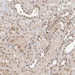 TNRC18 Antibody in Immunohistochemistry (Paraffin) (IHC (P))