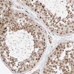 TNRC18 Antibody in Immunohistochemistry (Paraffin) (IHC (P))