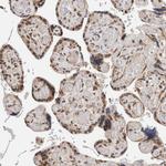 TNRC18 Antibody in Immunohistochemistry (IHC)