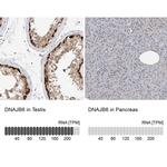 DNAJB6 Antibody in Immunohistochemistry (IHC)