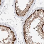 DNAJB6 Antibody in Immunohistochemistry (IHC)