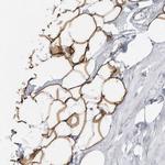 Perilipin 1 Antibody in Immunohistochemistry (Paraffin) (IHC (P))