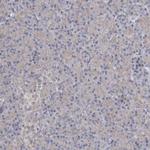 Perilipin 1 Antibody in Immunohistochemistry (Paraffin) (IHC (P))