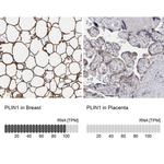 Perilipin 1 Antibody in Immunohistochemistry (IHC)