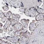 Perilipin 1 Antibody in Immunohistochemistry (IHC)