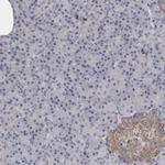 GDAP1 Antibody in Immunohistochemistry (IHC)