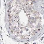 GDAP1 Antibody in Immunohistochemistry (IHC)