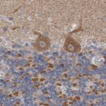 GDAP1 Antibody in Immunohistochemistry (IHC)